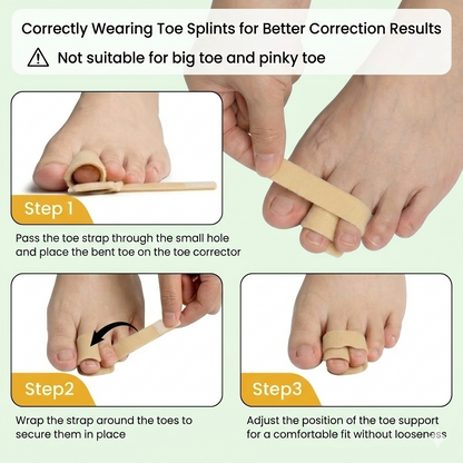 Alowat Hammered Toes Corrector