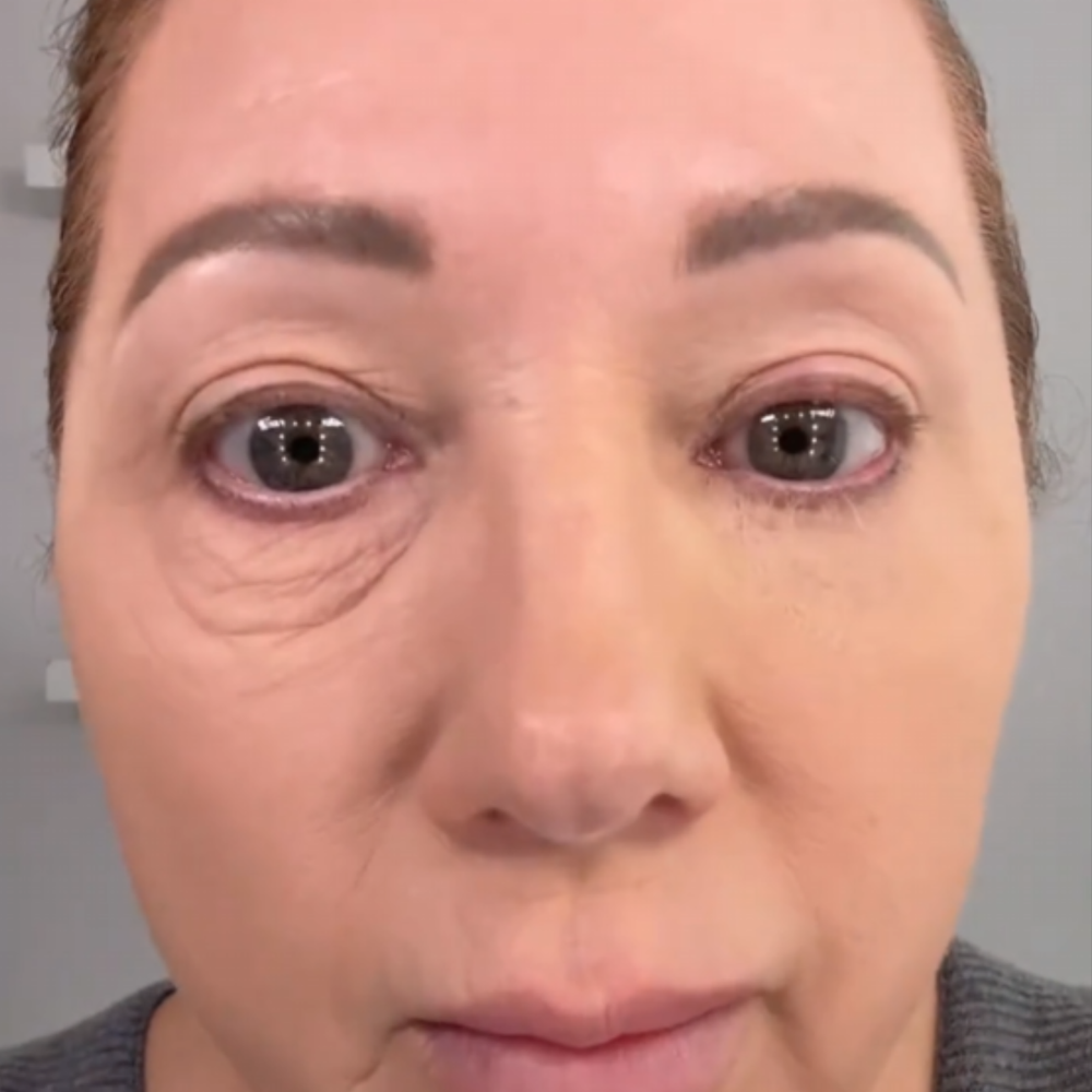 Alowat Instant Eyelift