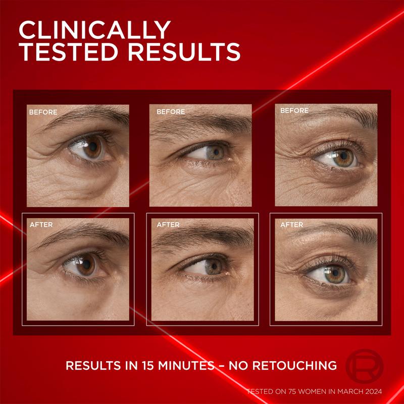 Alowat Instant Eyelift image Alowat Instant Eyelift